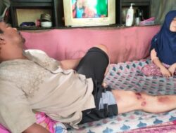 Tiga Warga Terluka Tertimpa Baligho Paslon Gubernur Jabar di Cibeber