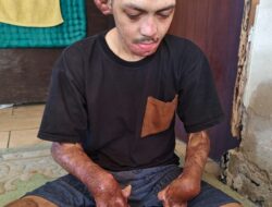 Terpenjara Luka, Terikat Asa, Kisah Rendi Menunggu Uluran Tangan