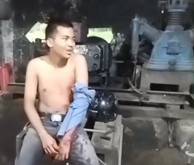 Korban kecelakaan di Sukaluyu, Cianjur, terlihat mengalami luka di tangan kiri setelah menabrak truk tronton parkir liar.