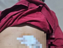 Rawan! Jalur Alternatif Cianjur–Jonggol Kembali Telan Korban Kejahatan Bersenjata