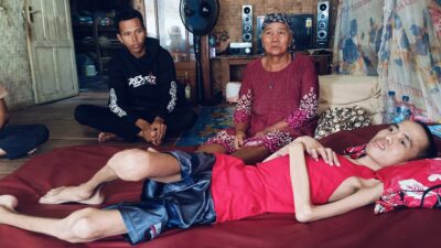 Tukang Jahit di Agrabinta Lumpuh 7 Tahun, Butuh Perhatian!