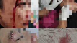 Kepala Dibenturkan hingga Tiga Jahitan, ASN Korban Dugaan KDRT Desak Polisi Percepat Penanganan