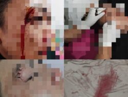 Kepala Dibenturkan hingga Tiga Jahitan, ASN Korban Dugaan KDRT Desak Polisi Percepat Penanganan
